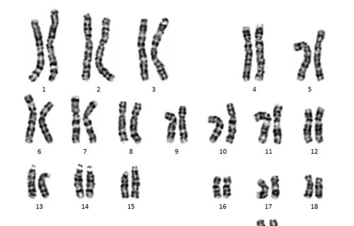 畸形染色体筛查怎么做？如何检查胎儿遗传病？