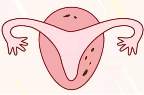 卵巢早衰试管率高吗？肯定会造成一定影响！